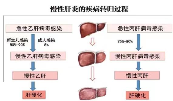 【健康科普】世界肝炎日——堅(jiān)持早預(yù)防，加強(qiáng)檢測(cè)發(fā)現(xiàn)，規(guī)范抗病毒治療